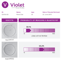 Vancouver-fertility-centre-discusses-AIs-ability-to-predict-egg-quality